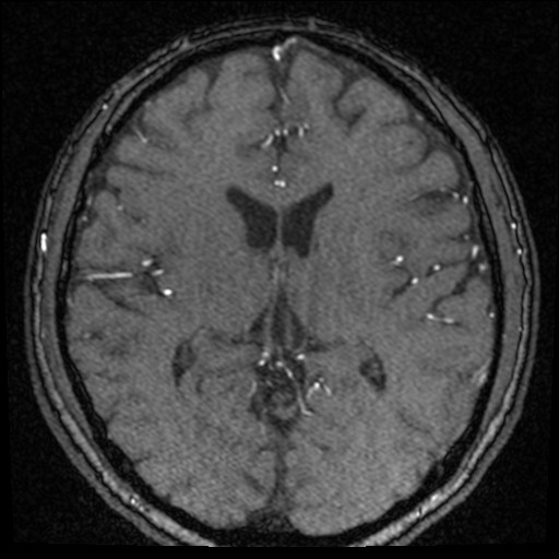 Click on the Serie image to view the images of VILLANUEVA, WILLIAM A.